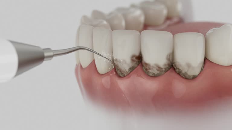 Reliable Dental Implants contractor in Coloma, MI by Smile Center Dentistry